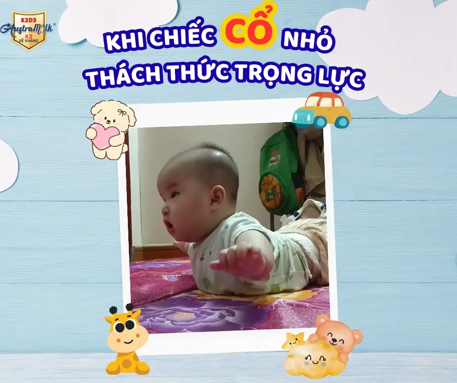 SERIES: 12 PLOT TWISTS ĐẦU ĐỜI. Plot Twist 3: KHI CHIẾC CỔ NHỎ THÁCH THỨC TRỌNG LỰC